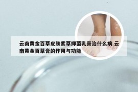 云南黄金百草皮肤紫草抑菌乳膏治什么病 云南黄金百草膏的作用与功能