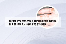 脚和腿上突然出现绿豆大的白斑是怎么回事 腿上有绿豆大小的白点是怎么回事