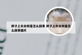 脖子上长白班是怎么回事 脖子上长白班是怎么回事图片