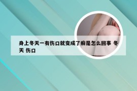 身上冬天一有伤口就变成了癣是怎么回事 冬天 伤口