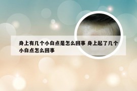 身上有几个小白点是怎么回事 身上起了几个小白点怎么回事