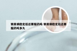 银屑病稳定后还要服药吗 银屑病稳定后还要服药吗多久