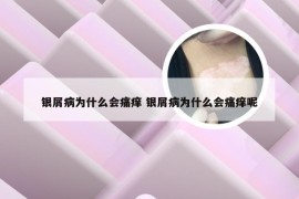 银屑病为什么会痛痒 银屑病为什么会痛痒呢