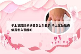 手上掌跖脓疱病是怎么引起的 手上掌趾脓疱病是怎么引起的