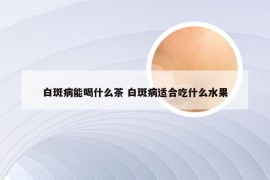 白斑病能喝什么茶 白斑病适合吃什么水果