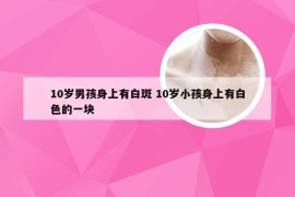 10岁男孩身上有白斑 10岁小孩身上有白色的一块