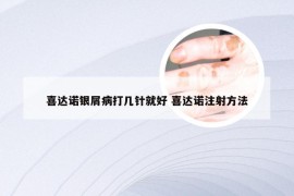 喜达诺银屑病打几针就好 喜达诺注射方法