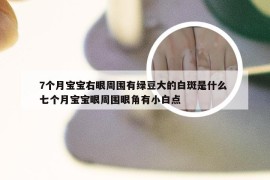 7个月宝宝右眼周围有绿豆大的白斑是什么 七个月宝宝眼周围眼角有小白点