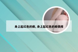 身上起红色的癣, 身上起红色的癣很痒