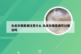 头皮长银屑病注意什么 头皮长银屑病可以根治吗