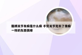 胳膊关节有癣是什么癣 手臂关节处长了像癣一样的东西很痒