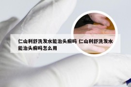 仁山利舒洗发水能治头癣吗 仁山利舒洗发水能治头癣吗怎么用