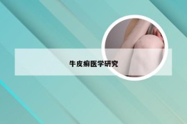 牛皮癣医学研究