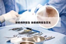 体癣病例报告 体癣病例报告范文