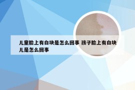 儿童脸上有白块是怎么回事 孩子脸上有白块儿是怎么回事