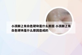 小孩脚上有白色硬块是什么原因 小孩脚上有白色硬块是什么原因造成的