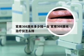 家用308激光多少钱一台 家用308激光治疗仪怎么样