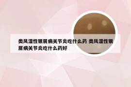 类风湿性银屑病关节炎吃什么药 类风湿性银屑病关节炎吃什么药好