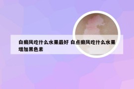 白癜风吃什么水果最好 白点癫风吃什么水果增加黑色素