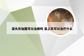 梁头灰加醋可以治癣吗 梁上灰可以治疗什么