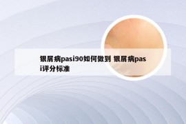 银屑病pasi90如何做到 银屑病pasi评分标准