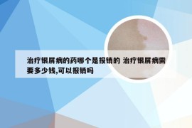 治疗银屑病的药哪个是报销的 治疗银屑病需要多少钱,可以报销吗