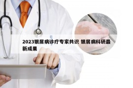 2023银屑病诊疗专家共识 银屑病科研最新成果