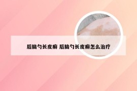 后脑勺长皮癣 后脑勺长皮癣怎么治疗