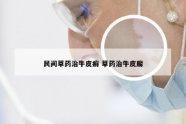 民间草药治牛皮癣 草药治牛皮廨