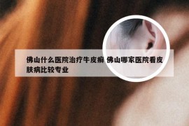 佛山什么医院治疗牛皮癣 佛山哪家医院看皮肤病比较专业