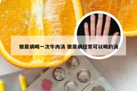 银屑病喝一次牛肉汤 银屑病经常可以喝的汤