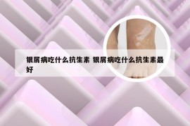 银屑病吃什么抗生素 银屑病吃什么抗生素最好