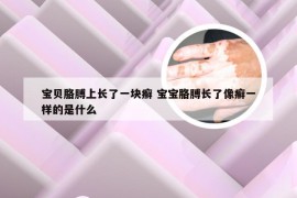 宝贝胳膊上长了一块癣 宝宝胳膊长了像癣一样的是什么