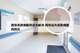 西安皮肤病医院远大解决 西安远大皮肤病医院院长