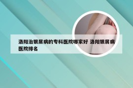 洛阳治银屑病的专科医院哪家好 洛阳银屑病医院排名