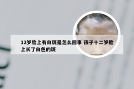 12岁脸上有白斑是怎么回事 孩子十二岁脸上长了白色的斑