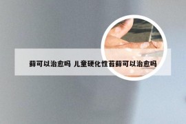 藓可以治愈吗 儿童硬化性苔藓可以治愈吗