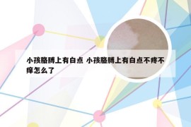 小孩胳膊上有白点 小孩胳膊上有白点不疼不痒怎么了