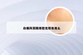 白癜风初期用他克擦有用么