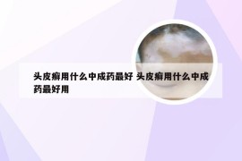 头皮癣用什么中成药最好 头皮癣用什么中成药最好用