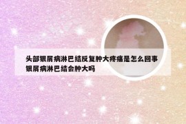 头部银屑病淋巴结反复肿大疼痛是怎么回事 银屑病淋巴结会肿大吗