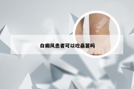 白癜风患者可以吃桑葚吗