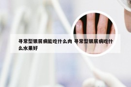 寻常型银屑病能吃什么肉 寻常型银屑病吃什么水果好