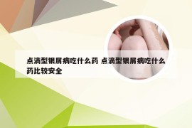 点滴型银屑病吃什么药 点滴型银屑病吃什么药比较安全