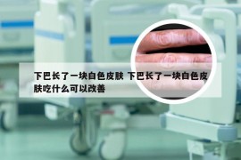 下巴长了一块白色皮肤 下巴长了一块白色皮肤吃什么可以改善