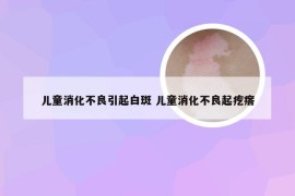 儿童消化不良引起白斑 儿童消化不良起疙瘩