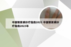 中国银屑病诊疗指南2023 中国银屑病诊疗指南2023年