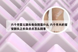 六个月婴儿额头有白斑是什么 六个月大的宝宝额头上长白点点怎么回事