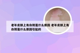 老年皮肤上有白斑是什么原因 老年皮肤上有白斑是什么原因引起的