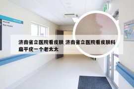 济南省立医院看皮肤 济南省立医院看皮肤科扁平疣一个老太太